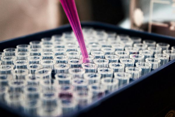 Navigation to Story: 2026—Nobel Prize in Medicine Awarded for Discoveries That Could Change the Medical Industry