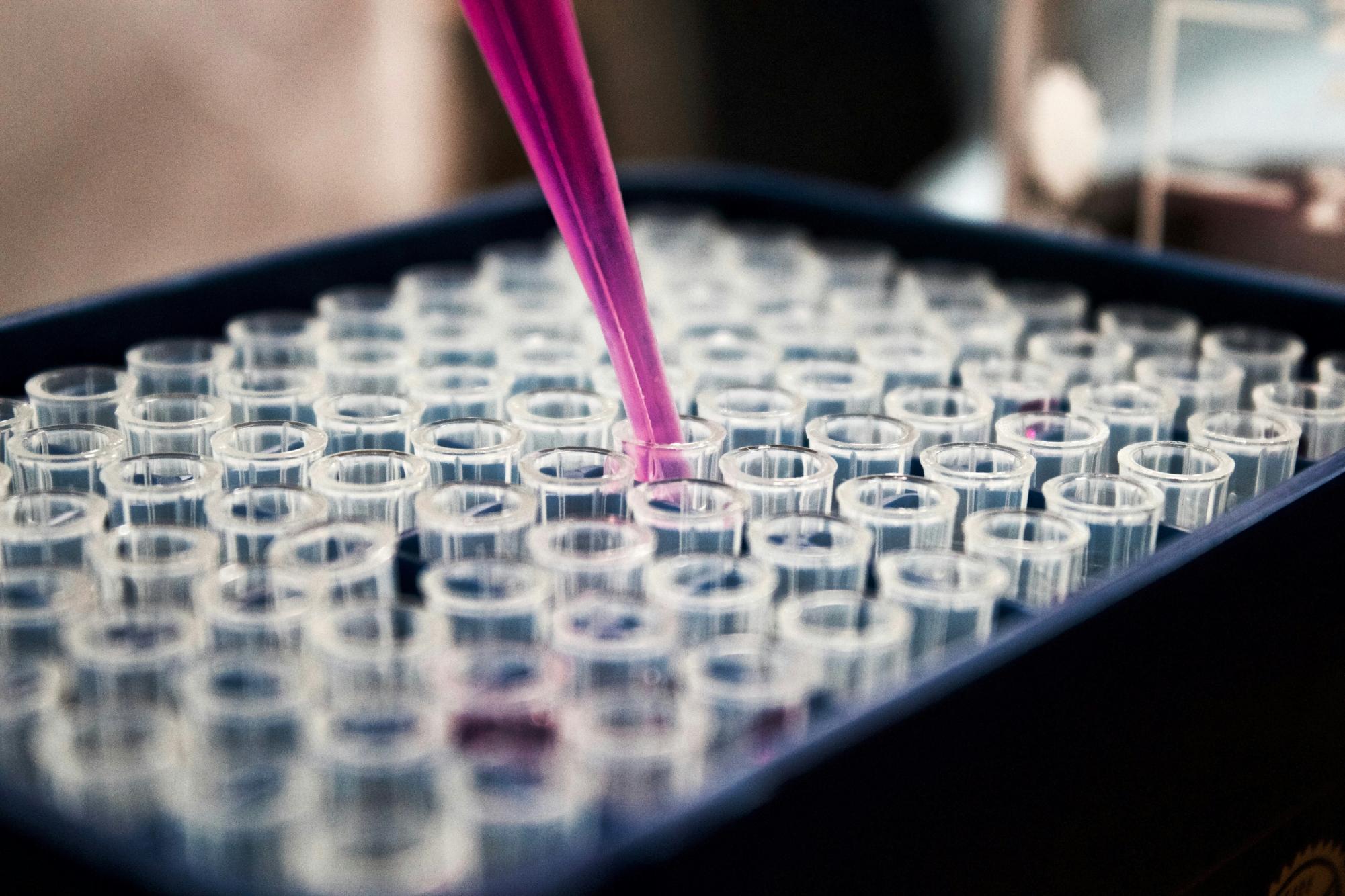 2026—Nobel Prize in Medicine Awarded for Discoveries That Could Change the Medical Industry